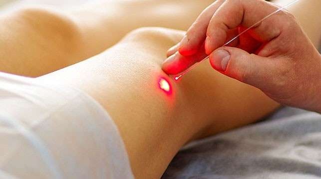 Ученые создали лазер для уничтожения раковых клеток крови