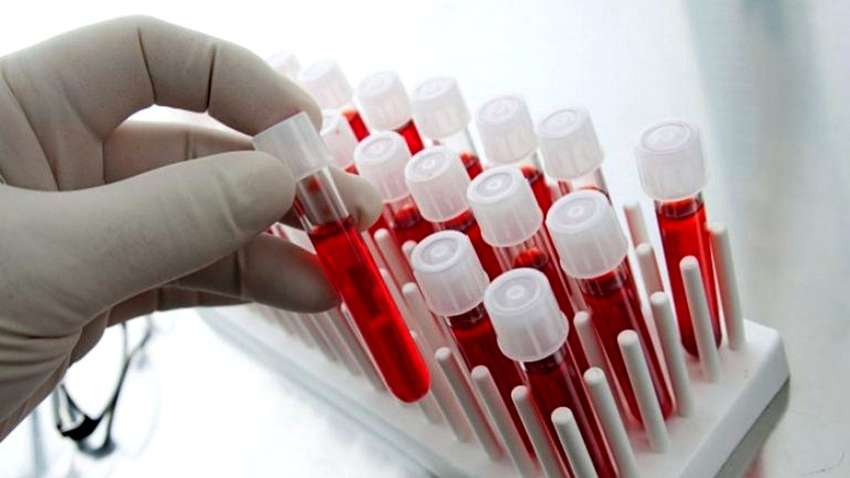 Какая группа крови увеличивает риск деменции