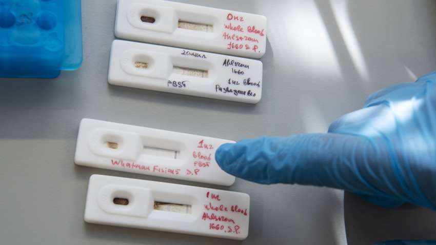 Прорыв в медицине: создан самый быстрый тест на коронавирус