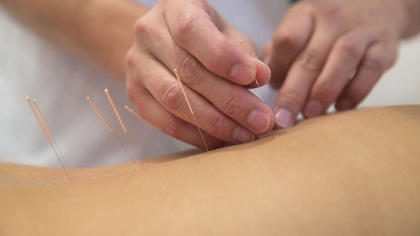 Женщине прокололи легкое вовремя иглоукалывания 