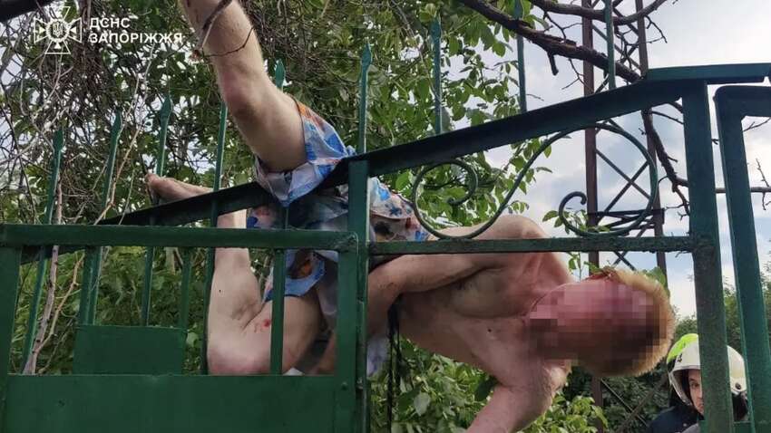 У Запоріжжі чоловік мало не загинув на паркані