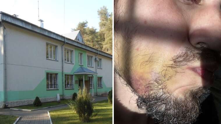 Мене катують та вимагають гроші – бізнесмен-біженець став заручником у Волинському ПТПІ