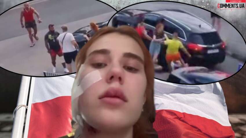Новый скандал с украинцами в Польше: молодая пара получила тяжелые травмы из-за языка Новый скандал с украинцами в Польше: молодая пара получила тяжелые травмы из-за языка
