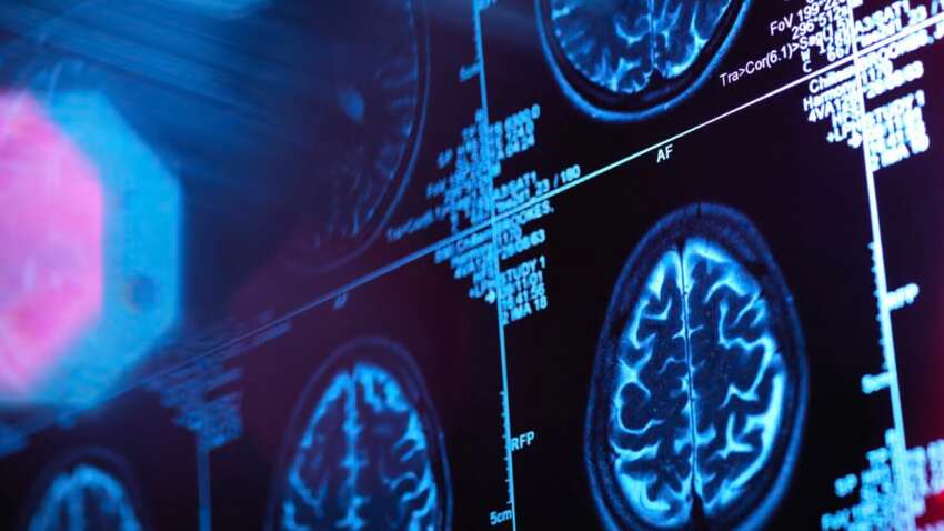 Дорослі лише після 32: що показало масштабне дослідження мозку Дорослі лише після 32: що показало масштабне дослідження мозку