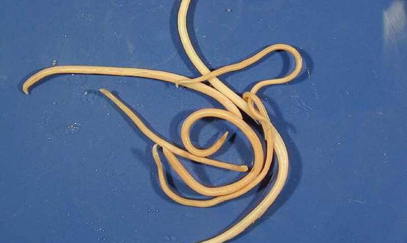 Откуда взялся 12-сантиметровый гельминт в глазу у мужчины Откуда взялся 12-сантиметровый гельминт в глазу у мужчины