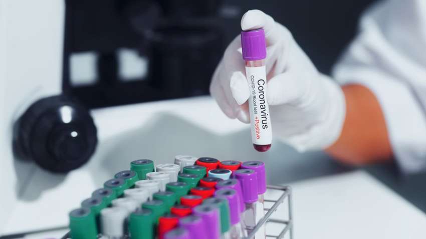 Статистика коронавірусу в Україні: скільки людей захворіло за добу