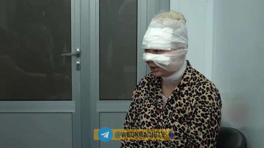 “Я думала, що втратила зір”: історія постраждалої внаслідок ракетної атаки в Одесі “Я думала, що втратила зір”: історія постраждалої внаслідок ракетної атаки в Одесі