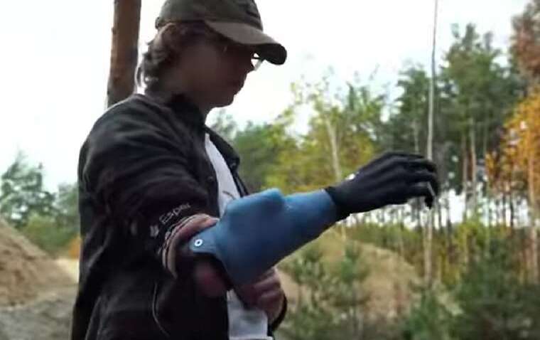 Украинские инженеры создали протез, «читающий» мнения человека: детали