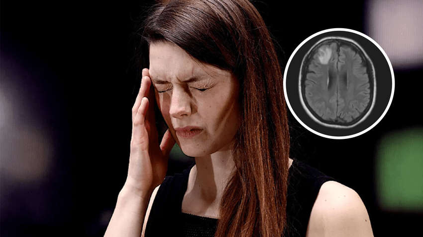 В Австралии в мозгу женщины обнаружили уникальную находку: никто этого не ожидал