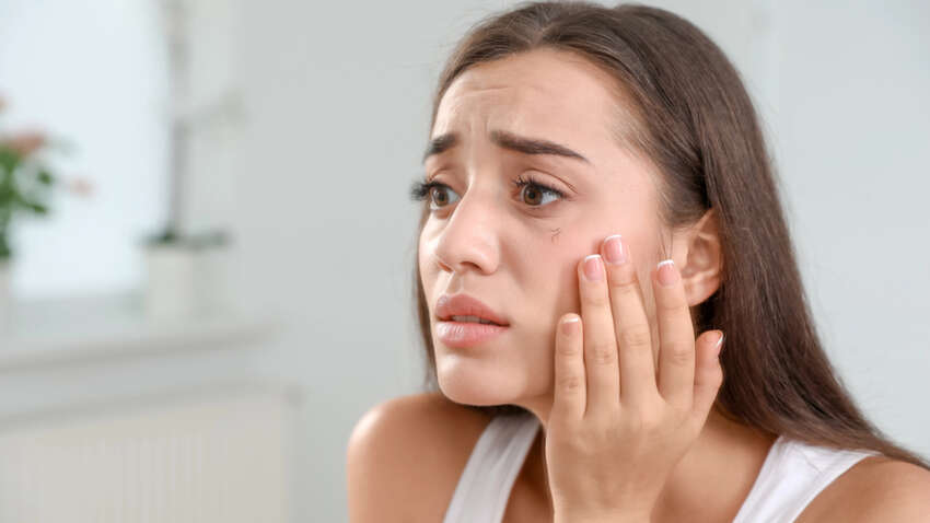 Почему появляются отеки именно перед важными событиями