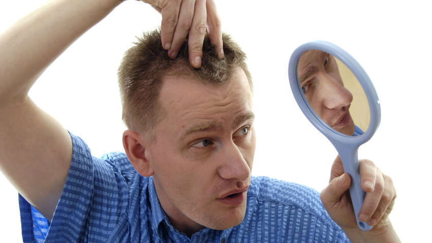 Як чоловік може протистояти облисінню