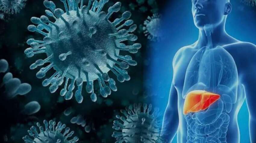 Спалах гепатиту А: в якому місті України оголошено карантин Спалах гепатиту А: в якому місті України оголошено карантин