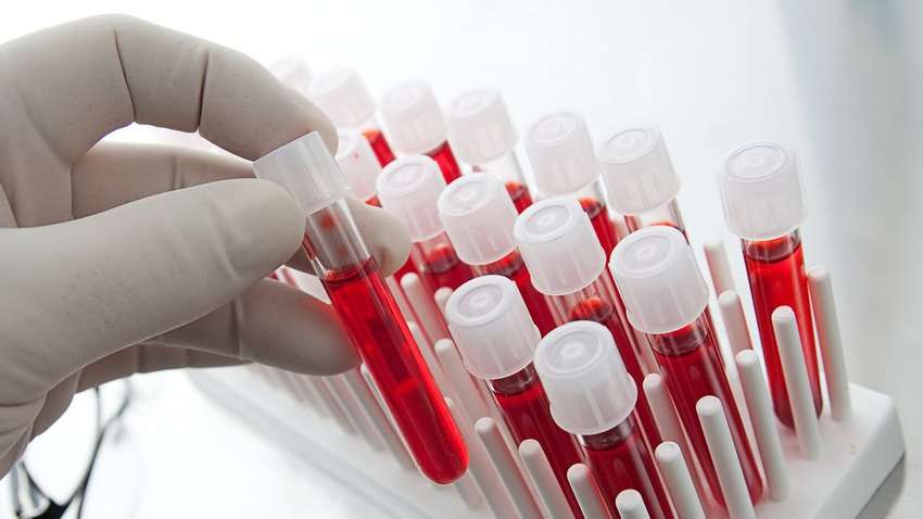 Украина начала тестировать методом ИФА: что он предполагает