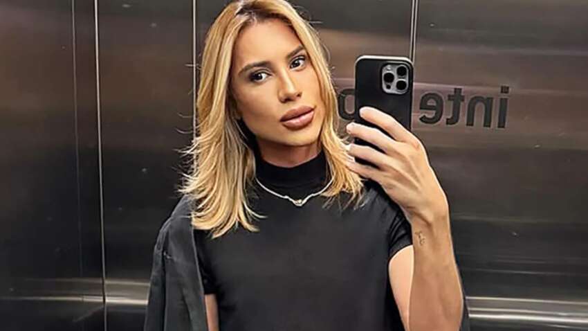 Инфлюэнсер умер после популярной пластической операции: что произошло