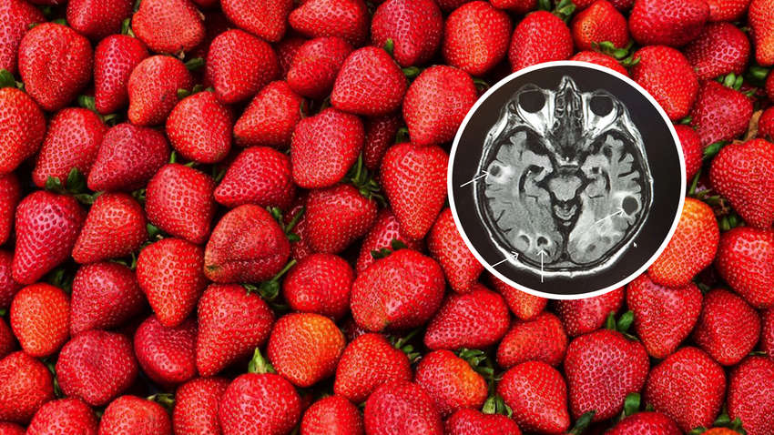 Мужчина съел грязную клубнику: медик показал, что произошло с его мозгом