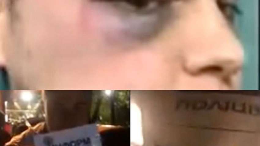 В Харькове напали на журналиста, который снимал нарушителей карантина (ФОТО, ВИДЕО)