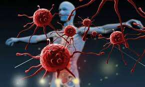 Ці «тихі види раку» вбивають непомітно через відсутність загрозливих симптомів Ці «тихі види раку» вбивають непомітно через відсутність загрозливих симптомів