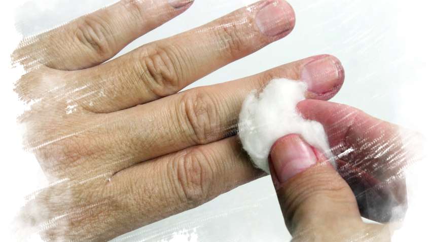 Отмываем кожу от зеленки: несколько полезных лайфхаков