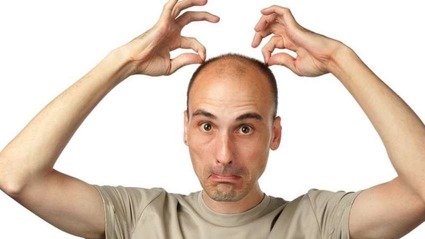 Експерти назвали одну з головних причин облисіння у чоловіків