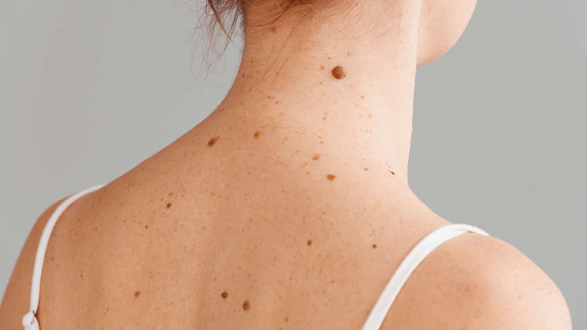 На проблемы с каким органом указывают красные родинки