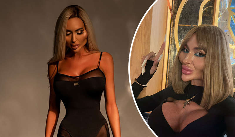 "Я не идиотка": блоггерша назвала пластические операции, на которые не согласится даже за миллион