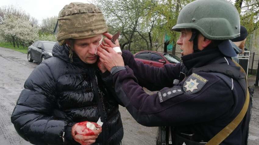 Кровавое задержание на Днепропетровщине: пятеро полицейских ранены