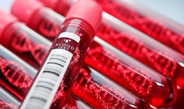 Японские ученые создали универсальную искусственную кровь