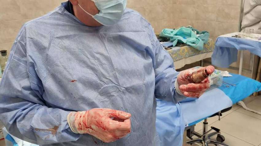 Шок: Из груди армейца медики достали целую гранату