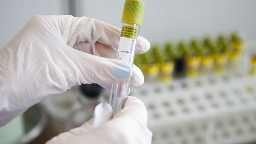 Днепр выделяет почти 100 млн грн на борьбу с коронавирусом