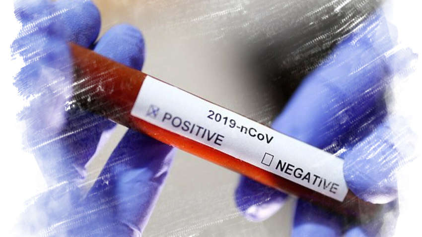 Новый рекорд: коронавирус в Украине снова пошел в атаку Новый рекорд: коронавирус в Украине снова пошел в атаку