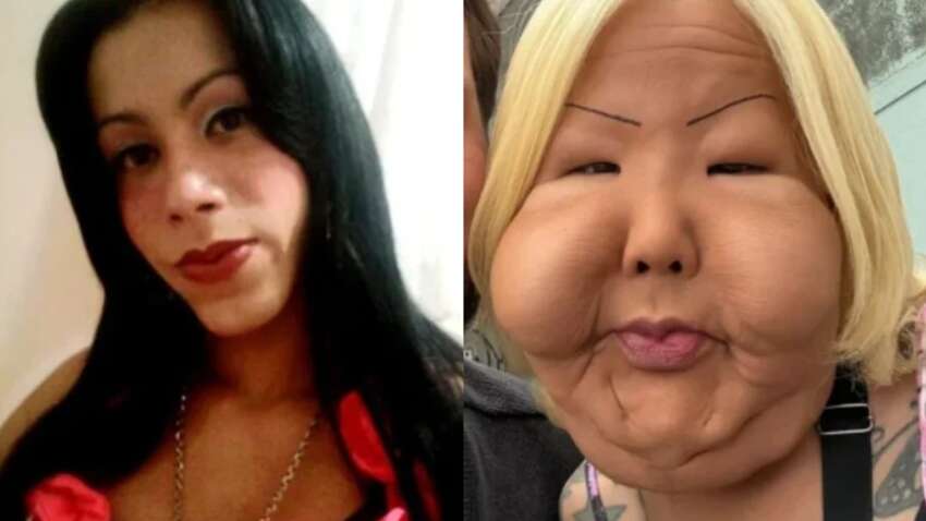 Інфлюенсерка хотіла змінити обличчя: косметична процедура перетворила її життя на жах (ФОТО)