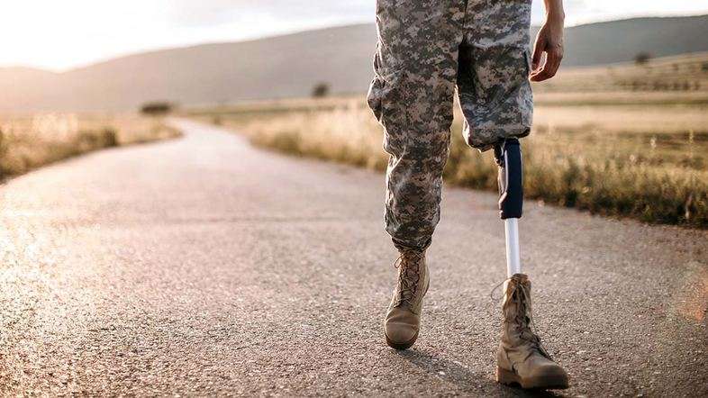 Теперь военным будет проще получить бесплатный протез: какие документы перестанут требовать Теперь военным будет проще получить бесплатный протез: какие документы перестанут требовать