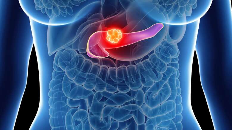 Скрытый панкреатит: чем страшна болезнь поджелудочной