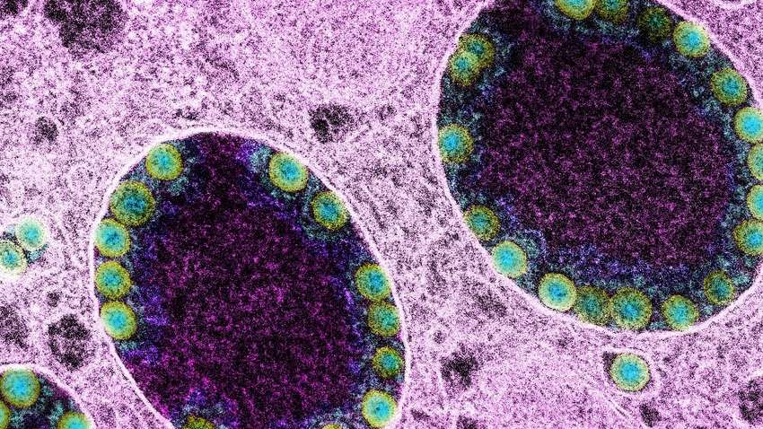 В мире распространяется Flurona – микс COVID-19 и гриппа