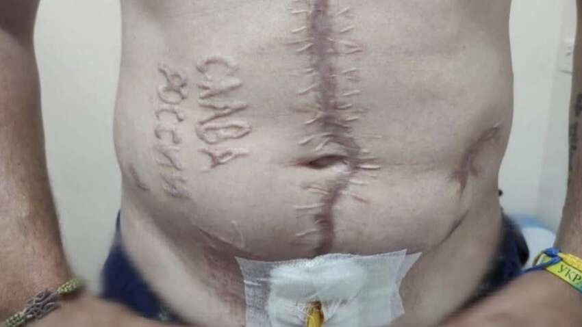 Історія військового зі шрамом «слава росії»