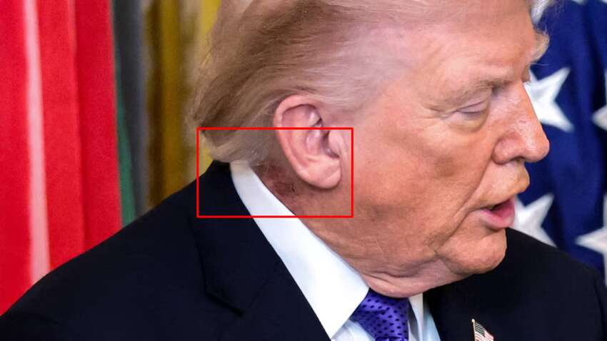 Врач Белого дома объяснил загадочные следы на шее Трампа (ФОТО) Врач Белого дома объяснил загадочные следы на шее Трампа (ФОТО)