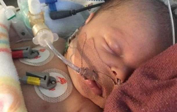 Новорожденный в Великобритании пережил 3 клинические смерти подряд