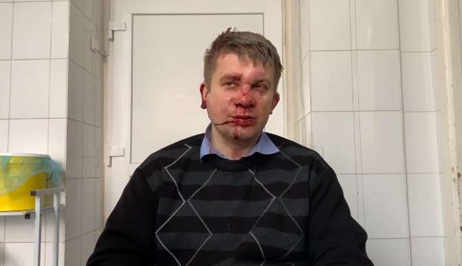 Запоріжжя жорстоко побили депутата: всі подробиці (відео)