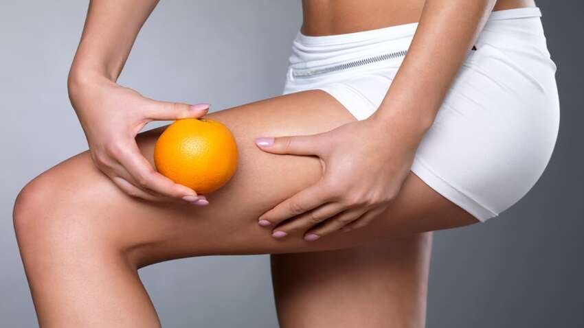 Перша звичка, яка викликає целюліт, та як від неї позбавитися Перша звичка, яка викликає целюліт, та як від неї позбавитися