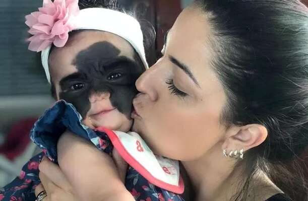 Девочка родилась с большой родинкой на лице: как она выглядит сегодня Девочка родилась с большой родинкой на лице: как она выглядит сегодня