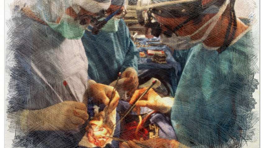 У Львові вперше провели операцію по пересадці серця