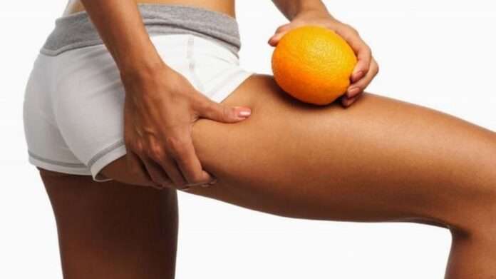 Супрун объяснила, что такое целлюлит и как с ним бороться