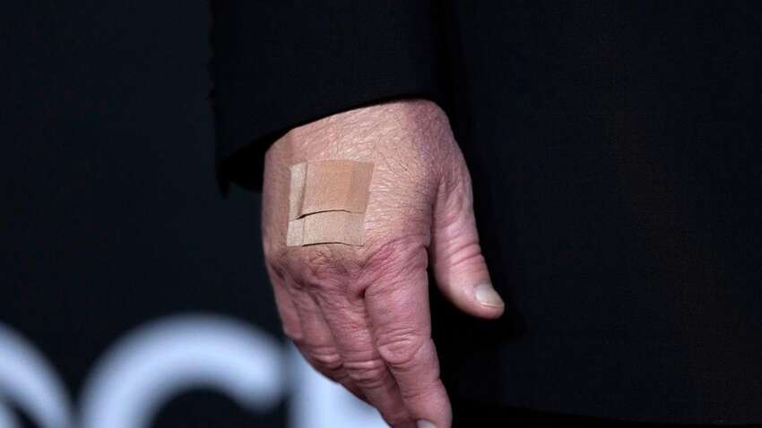 Почему Трамп продолжает носить повязку на руке: в Белом доме сделали два объяснения Почему Трамп продолжает носить повязку на руке: в Белом доме сделали два объяснения