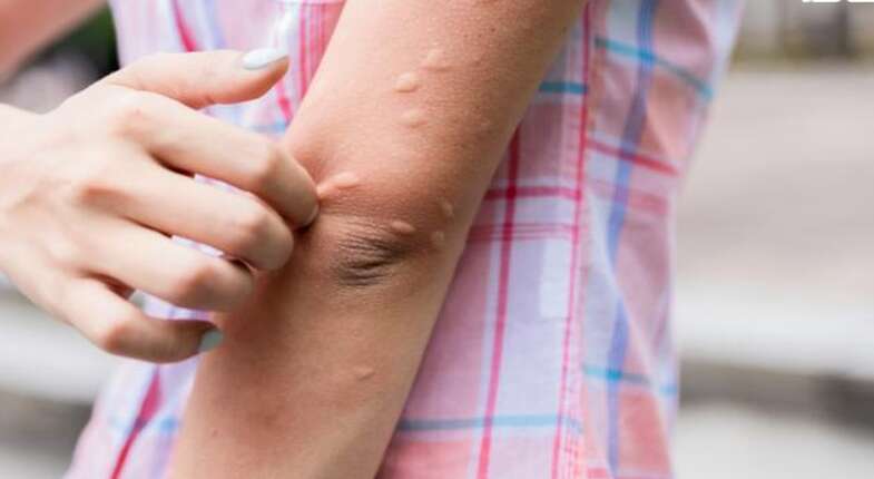 Вірус чикунгунья поширився вже у 16 країнах: кількість хворих стрімко зростає