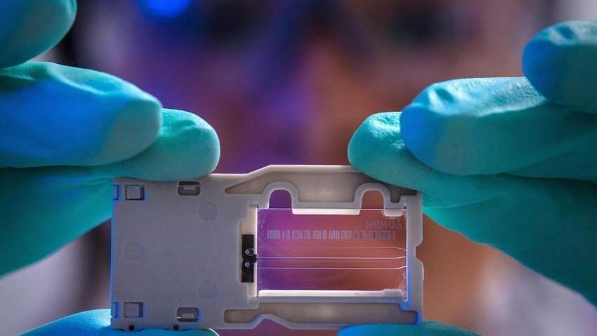 Более 1000 в Украине и почти 1,1 млн в мире: статистика коронавируса