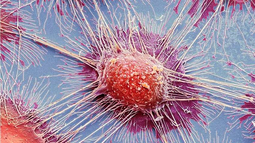 Крихітні магнітні роботи зможуть винищувати рак: подробиці експерименту