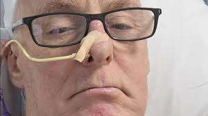 Мужчина удивился, когда узнал, что его рак горла вызвал оральный секс Мужчина удивился, когда узнал, что его рак горла вызвал оральный секс