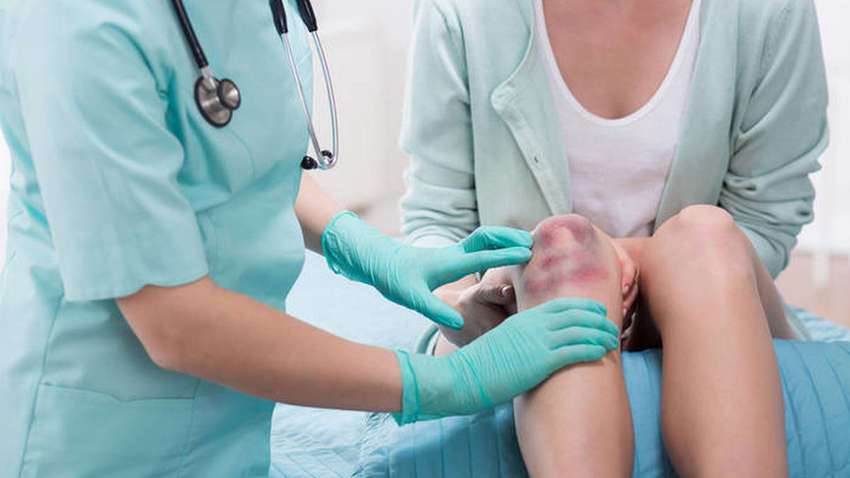 Синяки на коже: когда нужно срочно идти к врачу