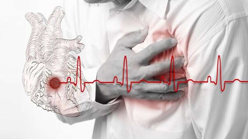 Как не пропустить инфаркт: симптомы скрытой формы, на которые следует обратить внимание Как не пропустить инфаркт: симптомы скрытой формы, на которые следует обратить внимание