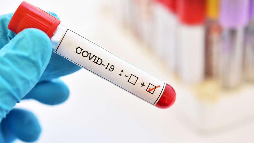 В ВОЗ дали неблагоприятный прогноз по поводу смертности от COVID-19 В ВОЗ дали неблагоприятный прогноз по поводу смертности от COVID-19